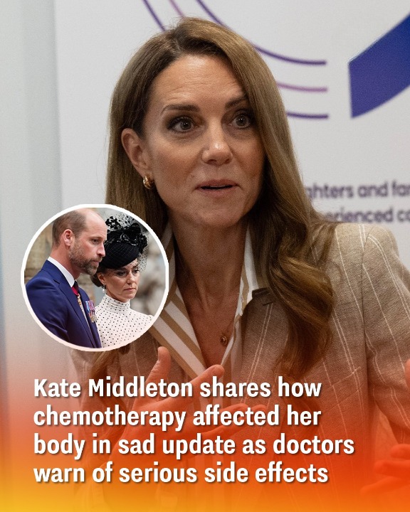Kate Middleton shares how chemotherapy affected her body in sad update as doctors warn of serious side effects
