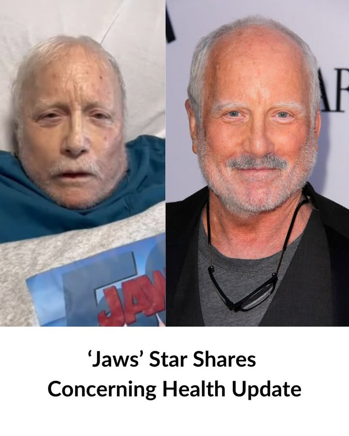 ‘Jaws’ Star Richard Dreyfuss, 77, Shares Concerning Health Update