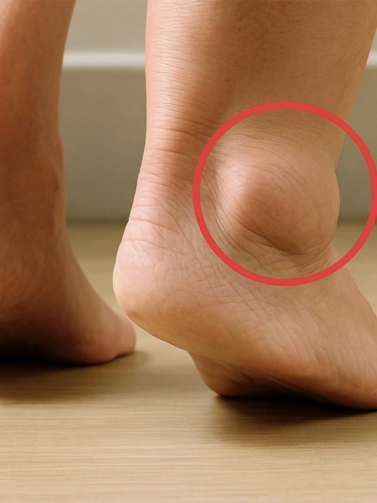 Swollen Legs: Understanding the Symptoms, Causes, and Treatments