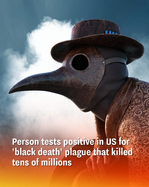 Person tests positive in US for ‘black death’ plague that kil.led tens of millions
