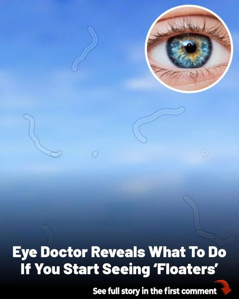 Eye Floaters: What They Are and How to Handle Them