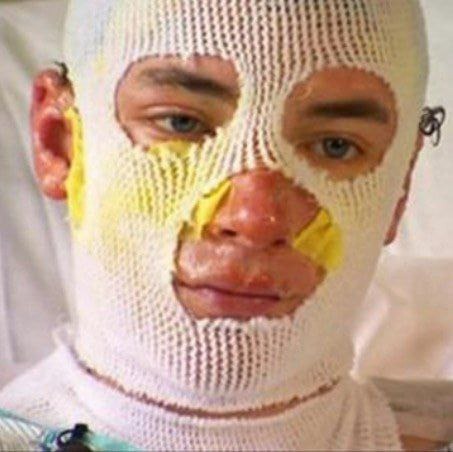 Uncle left with third-degree