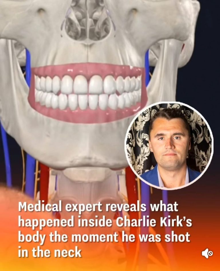 Charlie Kirk Shooting: What Happened in His Body