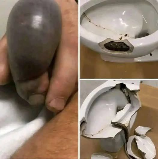 In several regions, while using their toilets