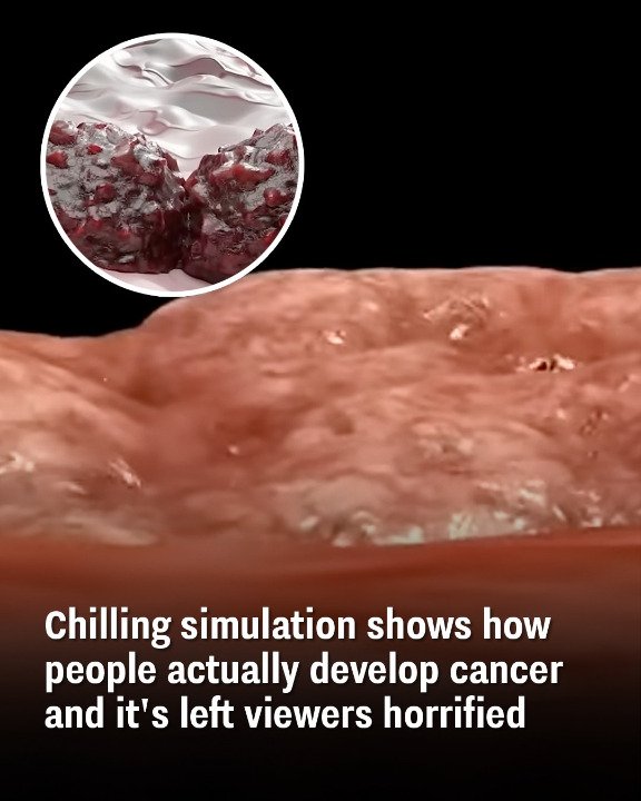 Chilling simulation shows how people actually develop cancer and it’s left viewers horrified