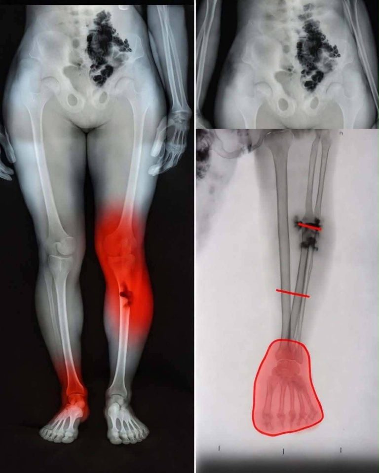 COVID-19 WARNING: Global alert for vaccinated people: this will happen to them too.