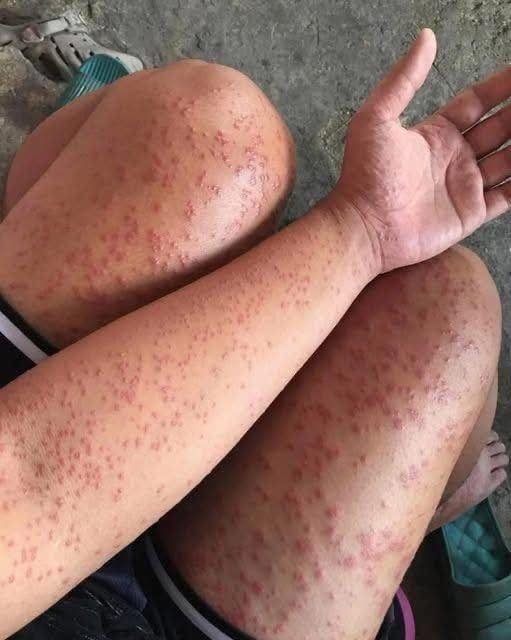 These are the consequences of sleeping with the…See more
